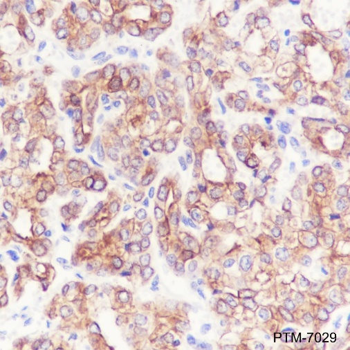 Anti-TGF beta 2 Mouse mAb