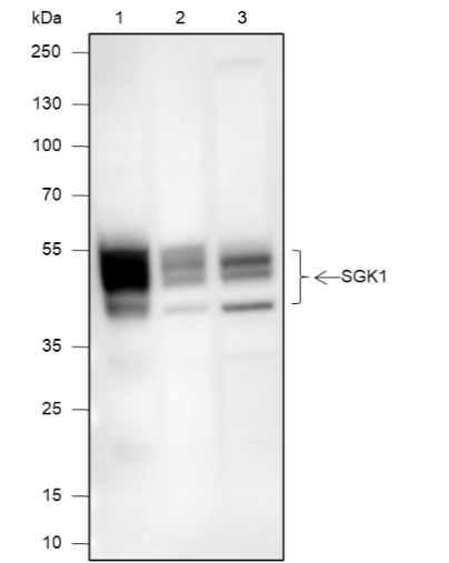 Anti-SGK1 Rabbit mAb