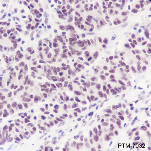 Anti-METTL3 Rabbit mAb