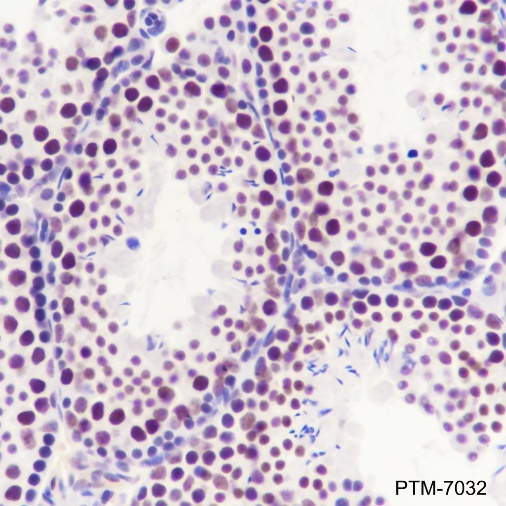Anti-METTL3 Rabbit mAb