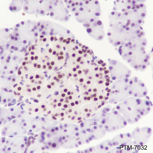 Anti-METTL3 Rabbit mAb