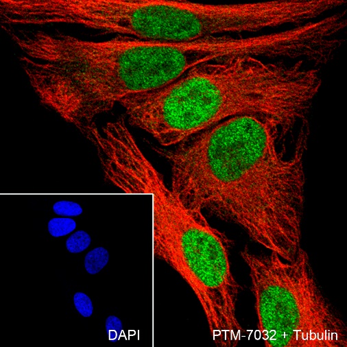Anti-METTL3 Rabbit mAb