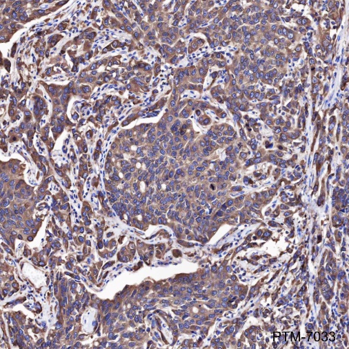 Anti-eIF4G1 Rabbit mAb
