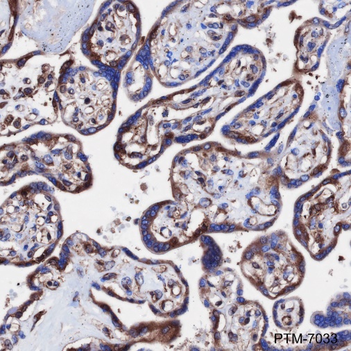 Anti-eIF4G1 Rabbit mAb