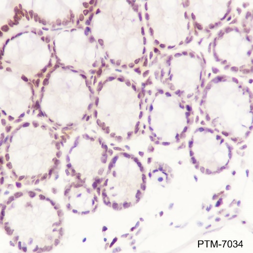 Anti-Histone H2A.Z Rabbit mAb