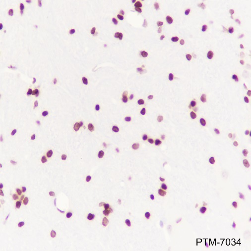 Anti-Histone H2A.Z Rabbit mAb