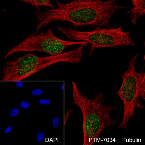 Anti-Histone H2A.Z Rabbit mAb