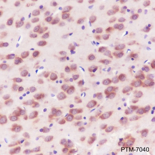 Anti-14-3-3 gamma Rabbit mAb