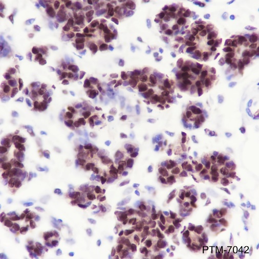 Anti-NFIB Rabbit mAb