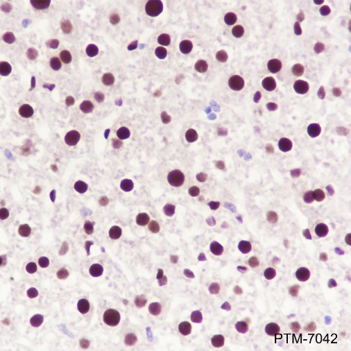 Anti-NFIB Rabbit mAb