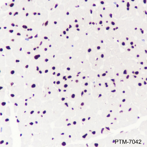 Anti-NFIB Rabbit mAb