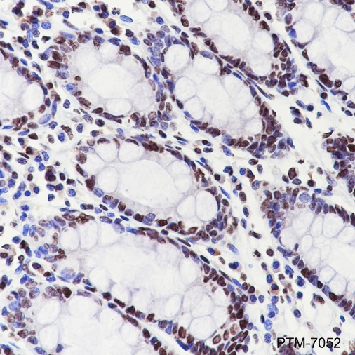 Anti-EWSR1/EWS Rabbit pAb