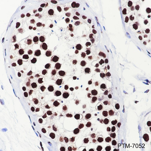 Anti-EWSR1/EWS Rabbit pAb