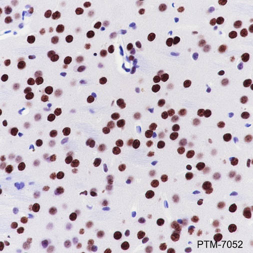 Anti-EWSR1/EWS Rabbit pAb