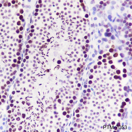 Anti-SP1 Rabbit mAb