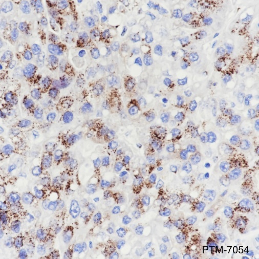 Anti-GOLPH2 Mouse mAb