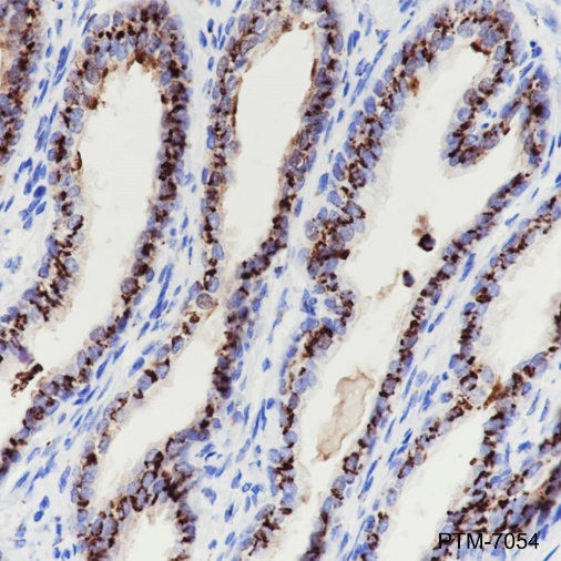 Anti-GOLPH2 Mouse mAb