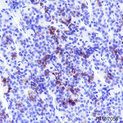Anti-ACTH Rabbit mAb