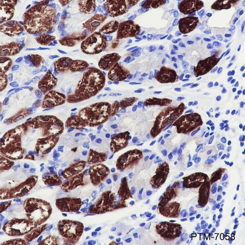 Anti-Creatine Kinase B Type Rabbit mAb