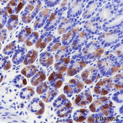 Anti-Creatine Kinase B Type Rabbit mAb