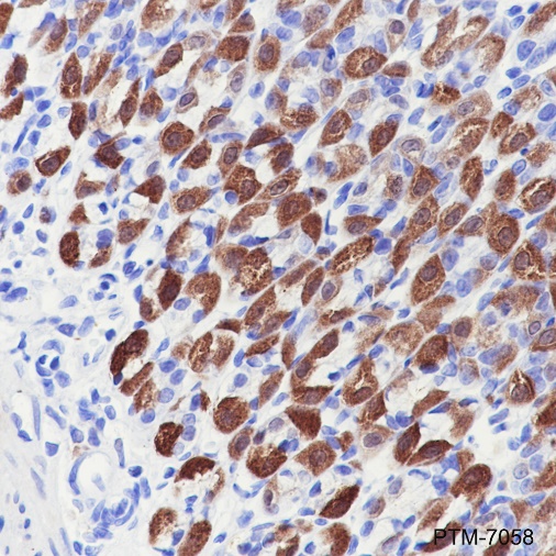 Anti-Creatine Kinase B Type Rabbit mAb
