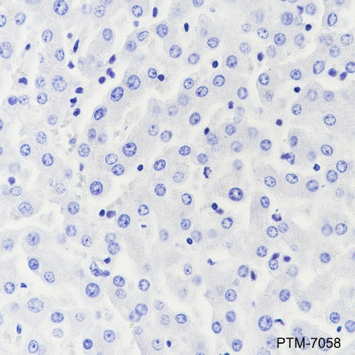 Anti-Creatine Kinase B Type Rabbit mAb