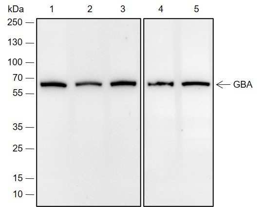 Anti-GBA Rabbit mAb