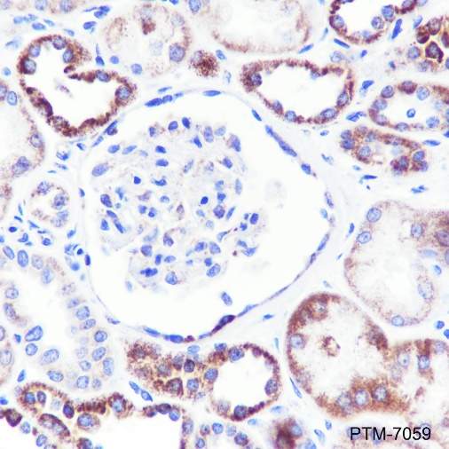 Anti-GBA Rabbit mAb
