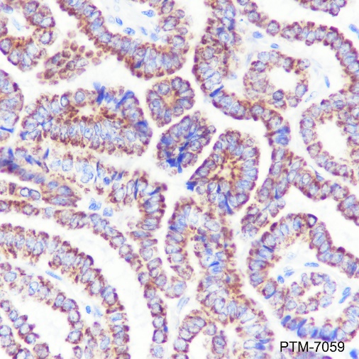 Anti-GBA Rabbit mAb