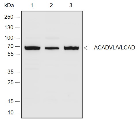 Anti-ACADVL/VLCAD Rabbit pAb