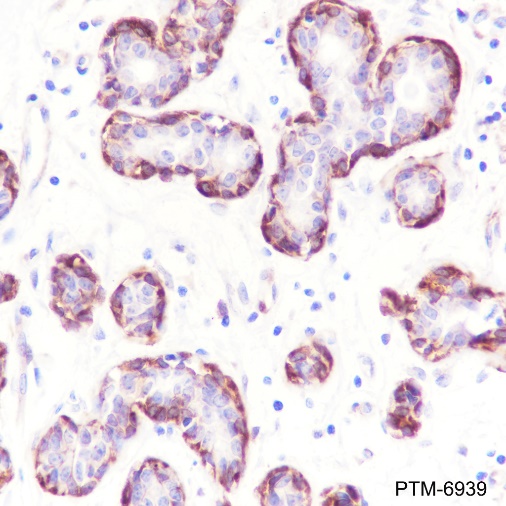 Anti-Vinculin Rabbit mAb