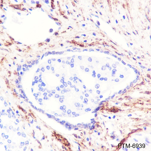 Anti-Vinculin Rabbit mAb