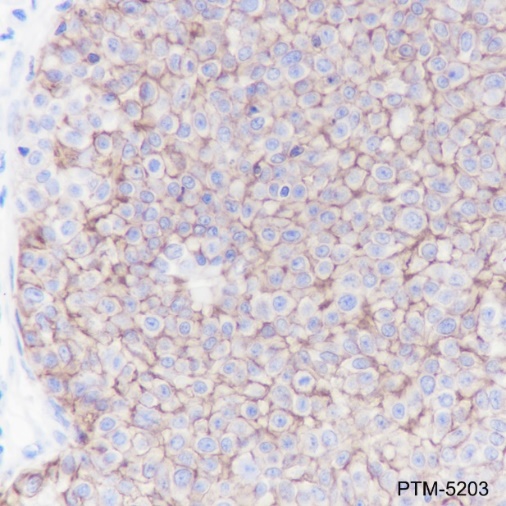 Anti-GLUT1 Rabbit mAb