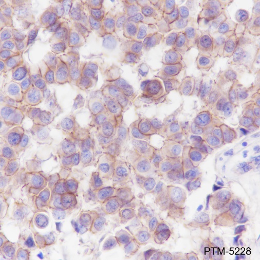 Anti-PI3 Kinase p110 alpha Rabbit mAb