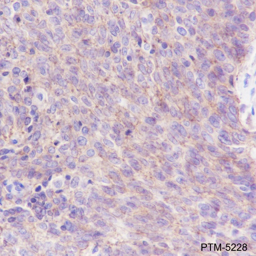 Anti-PI3 Kinase p110 alpha Rabbit mAb