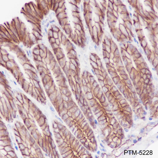 Anti-PI3 Kinase p110 alpha Rabbit mAb