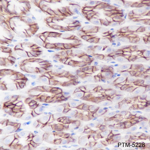 Anti-PI3 Kinase p110 alpha Rabbit mAb