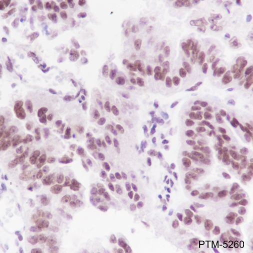 Anti-ATM Rabbit mAb