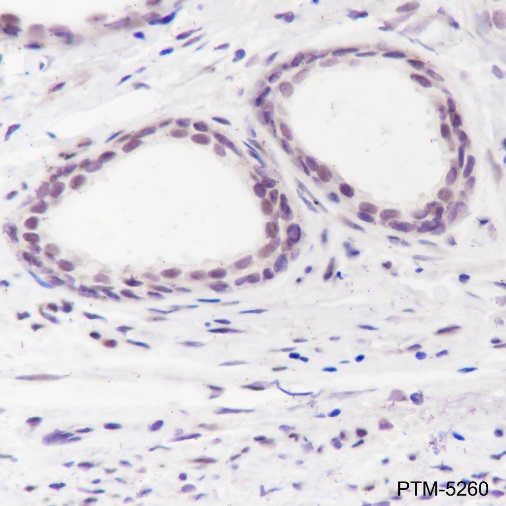 Anti-ATM Rabbit mAb
