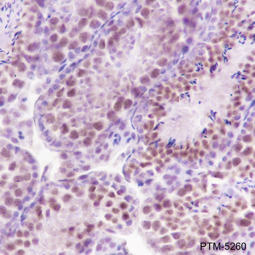 Anti-ATM Rabbit mAb