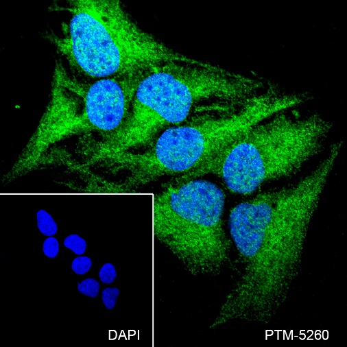 Anti-ATM Rabbit mAb