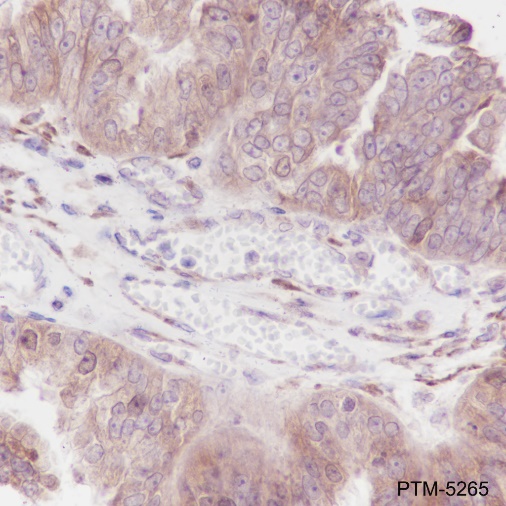Anti-Thymidylate Synthase Rabbit mAb