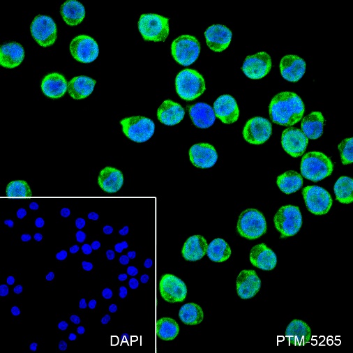 Anti-Thymidylate Synthase Rabbit mAb