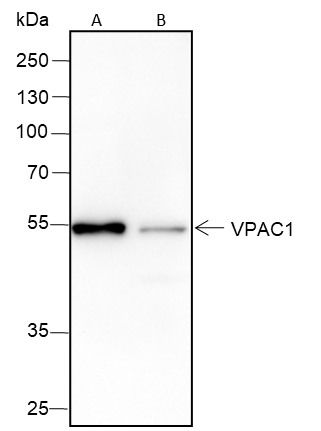 Anti-VPAC1 Rabbit mAb