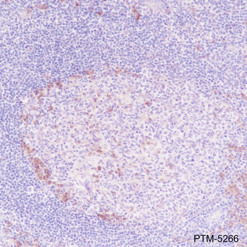 Anti-VPAC1 Rabbit mAb