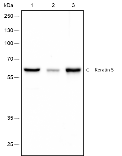 Anti-Keratin 5 Rabbit mAb