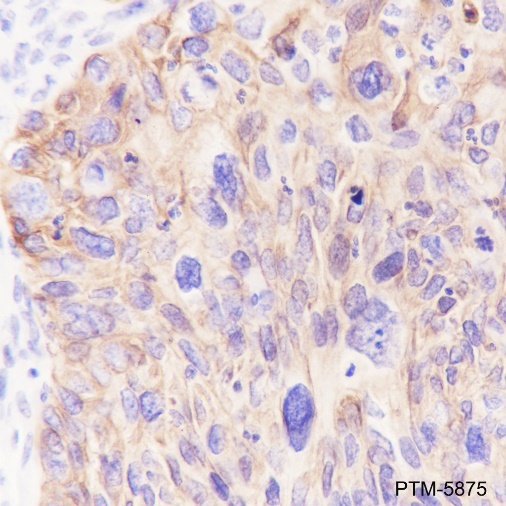 Anti-Keratin 5 Rabbit mAb