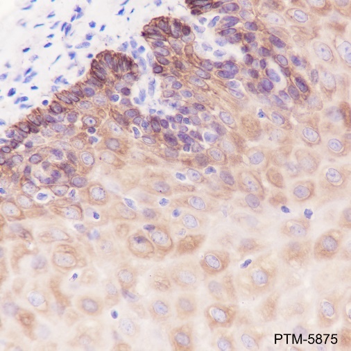 Anti-Keratin 5 Rabbit mAb