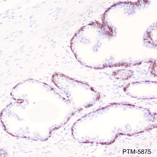 Anti-Keratin 5 Rabbit mAb