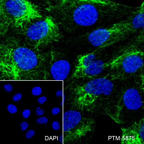Anti-Keratin 5 Rabbit mAb